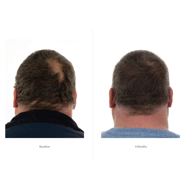 FOLIGAIN Triple Action Shampoo For Thinning Hair For Men with 2% Trioxidil 473ml - FOLIGAIN EUROPE