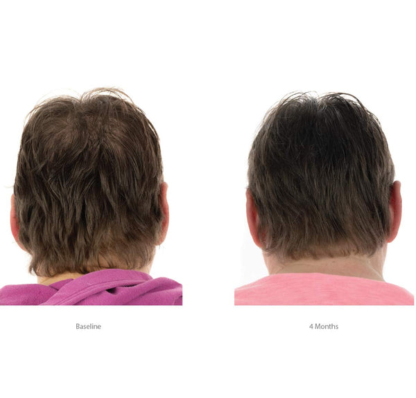 FOLIGAIN Triple Action Conditioner For Thinning Hair For Women with 2% Trioxidil - FOLIGAIN EUROPE